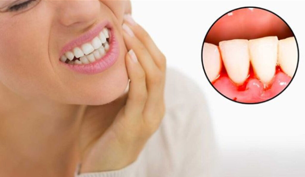 क्या दांत से खून आना घरेलू उपाय प्रभावी हैं?